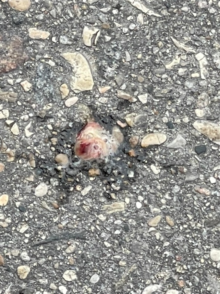 jennifer joy brenley nyhof pulmonary thrombi expectorated 2021